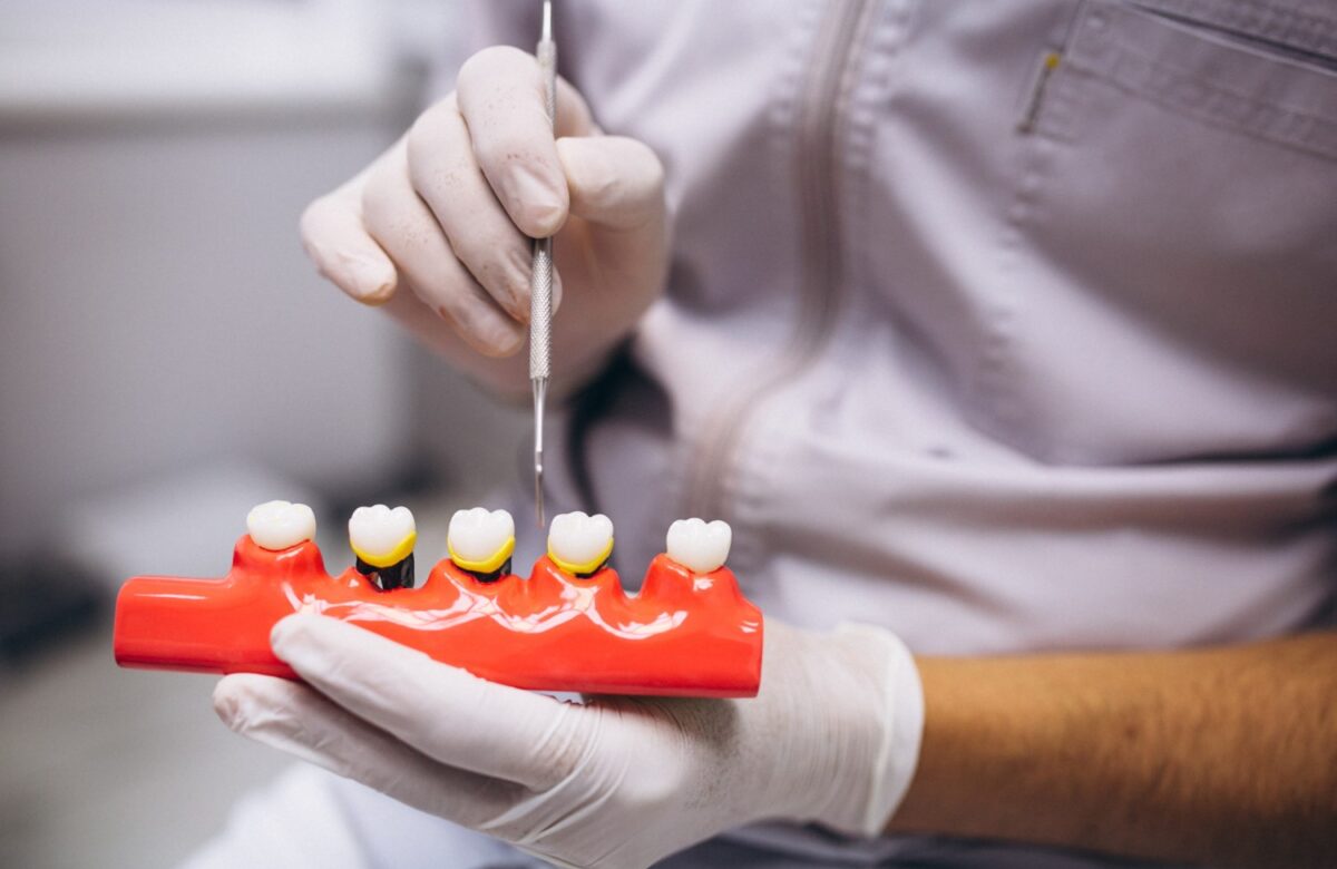 Poți beneficia de implant dentar dacă ai parodontoză?